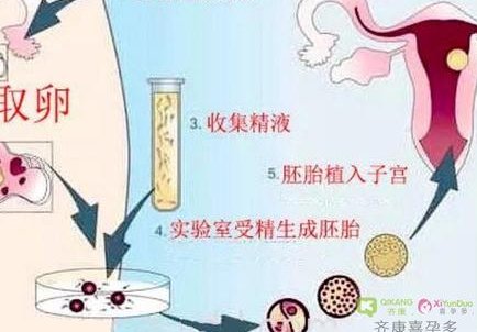 连云港试管婴儿医院哪里好？