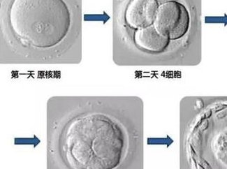 浅谈免疫有问题对试管婴儿是否有影响，警惕感染影响受孕率